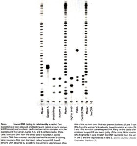 est de ADN por Southern blot de uso forense. Imagen de Lifecod Standford