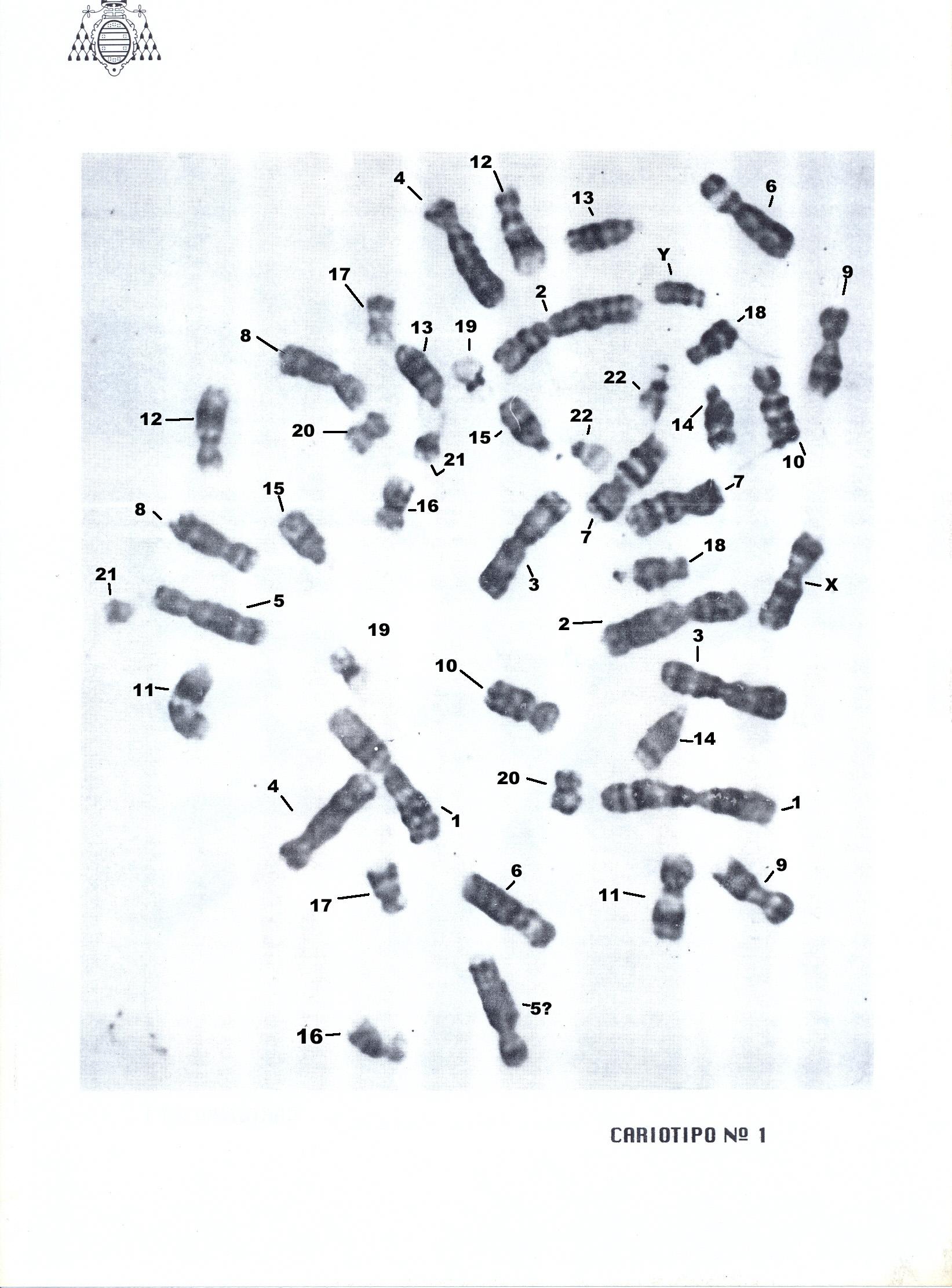 cariotipo_numerado