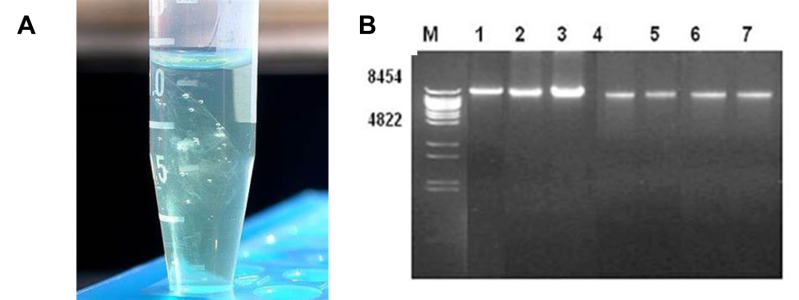 ADN en un microtubo se ve como una maraña en medio del agua y a la derecha de la imagen se observa un gel de agarosa con bromuro de etidio en foto blanco y negro.