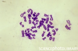 Metafase de cromosomas teñidos con giemsa, para realizar un cariotipo si bandas Fuente: Sciencephotolibrary