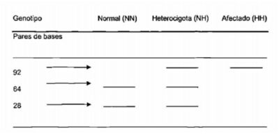 Figura 3: Ejemplo de interpretación de resultados del tratamiento de los productos de PCR con la enzima de restricción Taq I. Se muestra los genotipos homocigoto dominante (normal, NN) en el carril 1, heterocigoto (portador, NH) en el carril 2 y homocigoto recesivo (afectado, HH) en el carril 3. Se utilizó el marcador de peso molecular Hiperladder V para verificar el tamaño de los productos de PCR (Moreno Chapa, J. 2007).