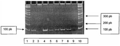 Figura 4. Ejemplo de visualización en el fotodocumentador  Fluor- S Multimager*1 (Bio- Rad) de la purificación de ADN a partir de muestras sanguíneas. Carriles 1 y 10: Marcador de peso molecular; carriles 2 a 8: productos de PCR; Carril 9: control negativo. Puede verse que todas las muestras, excepto la del carril 3,(quizá debido a errores de preparación de la mezcla de reacción para PCR siendo ideal que se repitiera el proceso de amplificación)  mostraron el producto de PCR esperado de 92 p. b. (Moreno Chapa, J . 2007)