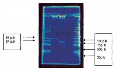 Figura 5: Ejemplo de visualización de análisis RFLP. Puede verse que la Muestra 1 tiene las bandas de 92 y 64 pb., mientras que la muestra 2 solo tiene la banda de 64 pb. La banda de la muestra 3 es un dímero de iniciador. (Moreno Chapa, J., 2007)